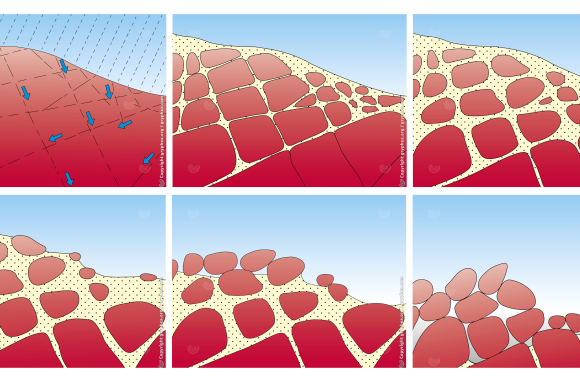 Etapes de la formation d'un chaos granitique